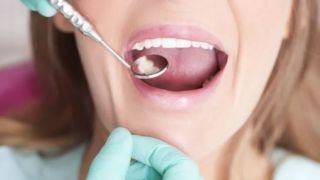 Cinque milioni di italiani rinunciano alle cure del dentista, un fondo integrativo per aiutarli